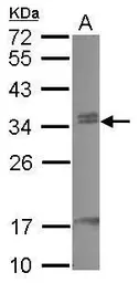 Anti-CBX7 antibody [N1C3] used in Western Blot (WB). GTX115712