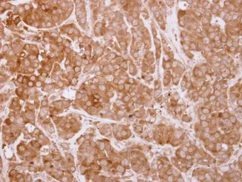 Anti-SH3BP1 antibody used in IHC (Paraffin sections) (IHC-P). GTX115734