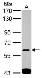 Anti-SH3BP1 antibody used in Western Blot (WB). GTX115734