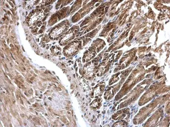 Anti-EDC4 antibody used in IHC (Paraffin sections) (IHC-P). GTX115745