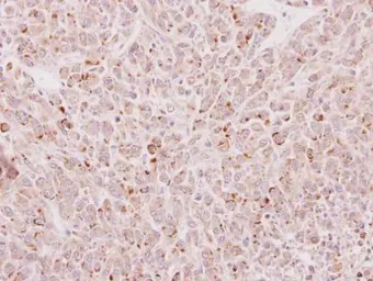 Anti-EDC4 antibody used in IHC (Paraffin sections) (IHC-P). GTX115745