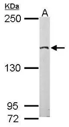 Anti-EDC4 antibody used in Western Blot (WB). GTX115745