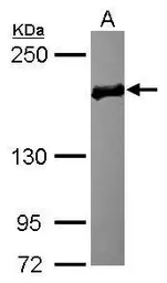 Anti-EDC4 antibody used in Western Blot (WB). GTX115745