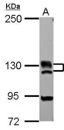 Anti-BRD1 antibody used in Western Blot (WB). GTX115758