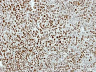 Anti-KIF4A antibody [N1N2], N-term used in IHC (Paraffin sections) (IHC-P). GTX115759