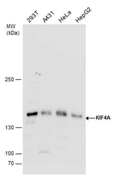 Anti-KIF4A antibody [N1N2], N-term used in Western Blot (WB). GTX115759