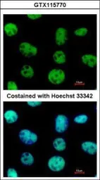 Anti-VAX2 antibody used in Immunocytochemistry/ Immunofluorescence (ICC/IF). GTX115770