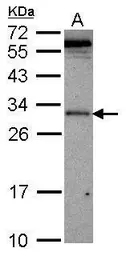 Anti-VAX2 antibody used in Western Blot (WB). GTX115770