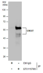 Anti-CREST antibody [N1C2] used in Immunoprecipitation (IP). GTX115785