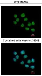 Anti-CREST antibody [N1C2] used in Immunocytochemistry/ Immunofluorescence (ICC/IF). GTX115785