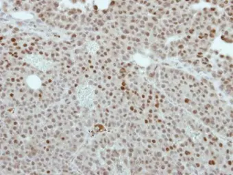 Anti-CREST antibody [N1C2] used in IHC (Paraffin sections) (IHC-P). GTX115785