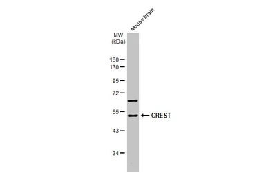 Anti-CREST antibody [N1C2] used in Western Blot (WB). GTX115785