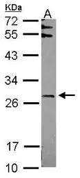 Anti-FBXO6 antibody used in Western Blot (WB). GTX115813