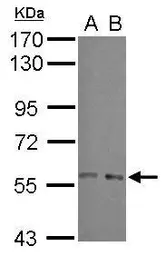 Anti-ARFGAP3 antibody [N1N2], N-term used in Western Blot (WB). GTX115819