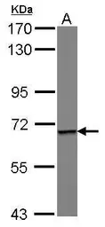 Anti-Epsin 1 antibody [C1C3] used in Western Blot (WB). GTX115900