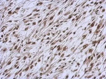 Anti-NARF antibody used in IHC (Paraffin sections) (IHC-P). GTX115913