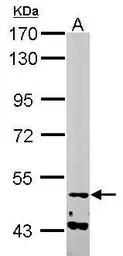 Anti-NARF antibody used in Western Blot (WB). GTX115913