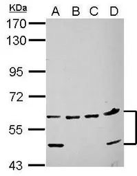 Anti-NARF antibody used in Western Blot (WB). GTX115913