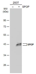 Anti-SPOP antibody [N3C3] used in Western Blot (WB). GTX115917