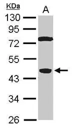 Anti-SPO11 antibody [N3C3] used in Western Blot (WB). GTX115927