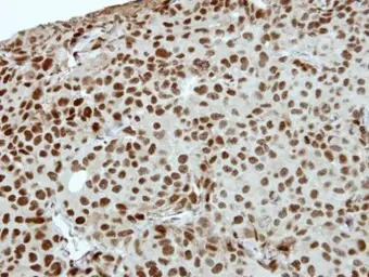 Anti-ZNF345 antibody [N1N3] used in IHC (Paraffin sections) (IHC-P). GTX115939