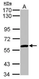 Anti-ZNF345 antibody [N1N3] used in Western Blot (WB). GTX115939