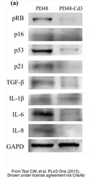 Anti-CXCL8 / IL8 antibody used in Western Blot (WB). GTX115959