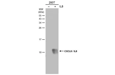 Anti-CXCL8 / IL8 antibody used in Western Blot (WB). GTX115959