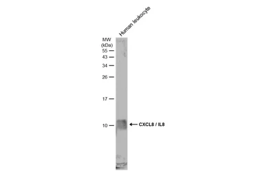 Anti-CXCL8 / IL8 antibody used in Western Blot (WB). GTX115959