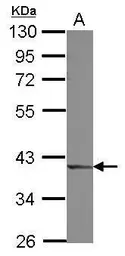 Anti-DCPS antibody used in Western Blot (WB). GTX115973