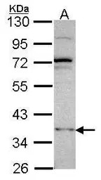 Anti-DNMT3L antibody [N1C1] used in Western Blot (WB). GTX115985