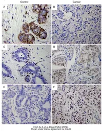 Anti-DNMT1 antibody [N1], N-term used in IHC (Paraffin sections) (IHC-P). GTX116011