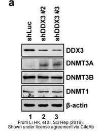 Anti-DNMT1 antibody [N1], N-term used in Western Blot (WB). GTX116011