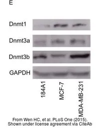 Anti-DNMT1 antibody [N1], N-term used in Western Blot (WB). GTX116011