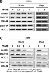 Anti-DNMT1 antibody [N1], N-term used in Western Blot (WB). GTX116011