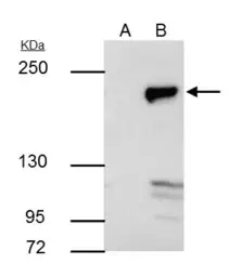 Anti-DNMT1 antibody [N1], N-term used in Immunoprecipitation (IP). GTX116011