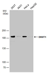 Anti-DNMT1 antibody [N1], N-term used in Western Blot (WB). GTX116011