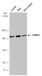 Anti-DNMT1 antibody [N1], N-term used in Western Blot (WB). GTX116011