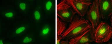 Anti-DNMT1 antibody [N1], N-term used in Immunocytochemistry/ Immunofluorescence (ICC/IF). GTX116011