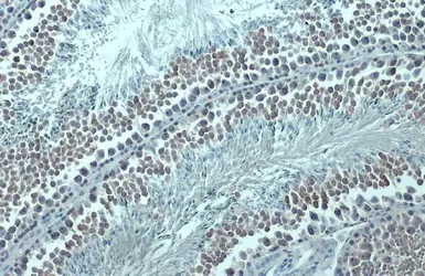 Anti-DNMT1 antibody [N1], N-term used in IHC (Paraffin sections) (IHC-P). GTX116011