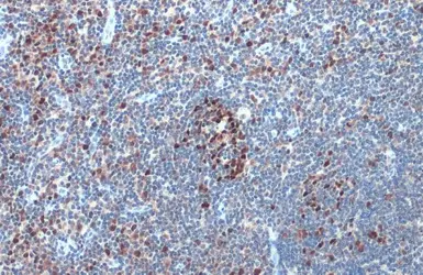 Anti-DNMT1 antibody [N1], N-term used in IHC (Paraffin sections) (IHC-P). GTX116011