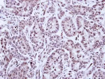 Anti-TAL1 antibody [C2C3], C-term used in IHC (Paraffin sections) (IHC-P). GTX116020