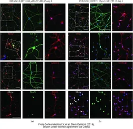 Anti-Tau antibody used in Immunocytochemistry/ Immunofluorescence (ICC/IF). GTX116044