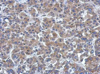 Anti-ARHGEF3 antibody [N1C1] used in IHC (Paraffin sections) (IHC-P). GTX116114