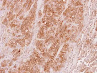 Anti-VPS36 antibody used in IHC (Paraffin sections) (IHC-P). GTX116124