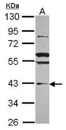 Anti-VPS36 antibody used in Western Blot (WB). GTX116124