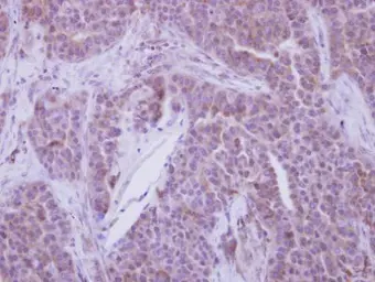 Anti-YBX2 antibody [N2C2], Internal used in IHC (Paraffin sections) (IHC-P). GTX116127