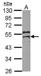 Anti-YBX2 antibody [N2C2], Internal used in Western Blot (WB). GTX116127