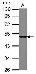 Anti-YBX2 antibody [N2C2], Internal used in Western Blot (WB). GTX116127