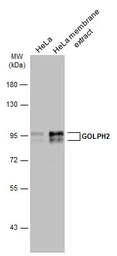 Anti-GOLPH2 antibody used in Western Blot (WB). GTX116154